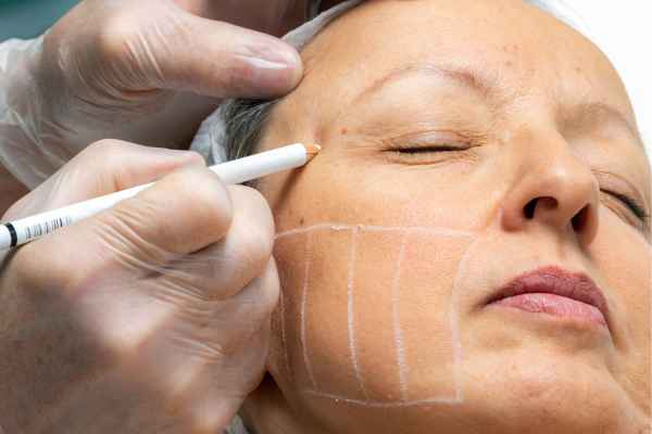 CryoPen: 5 Skin Concerns It May Be Used to Treat 4 What should you ask before having CryoPen treatment East Sussex?