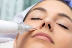 Best Actinic Keratoses Removal 3 Actinic keratoses East Sussex solutions - book in today!