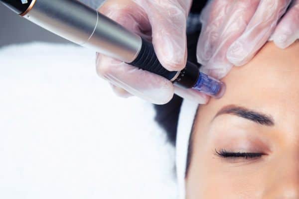 Explaining Total Skin Tightening Treatment and What to Expect 2 What Skin Concerns Can Total Skin Tightening Treatment Help With East Sussex?